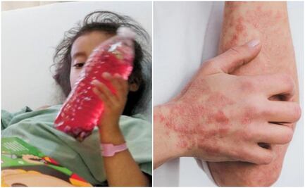 Por crisis sanitaria internacional, diputados alistan comparecencia de titulares de Cofepris e ISSSTE