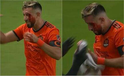 Héctor Herrera y su escandalosa herida en el rostro