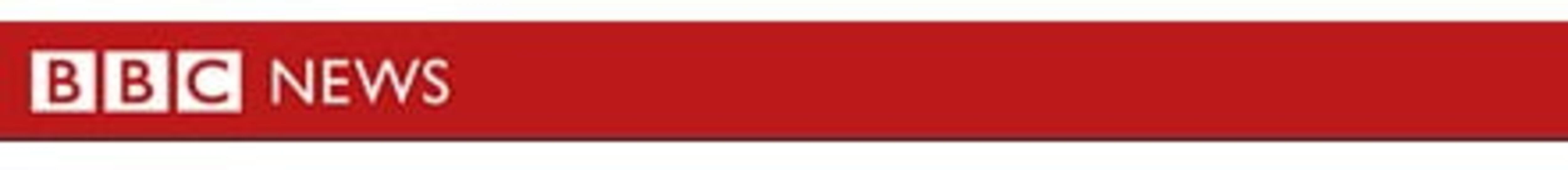 Cantó ópera mientras le extraían un tumor del cerebro