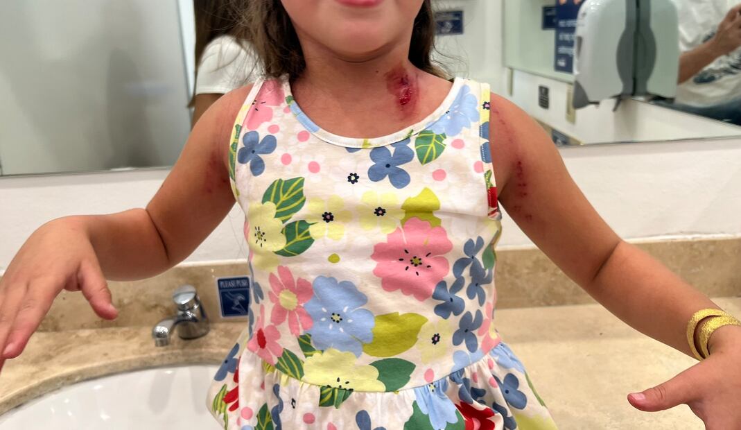 La menor no recibió atención por parte de Kartzone. Foto: Twitter @rojashector