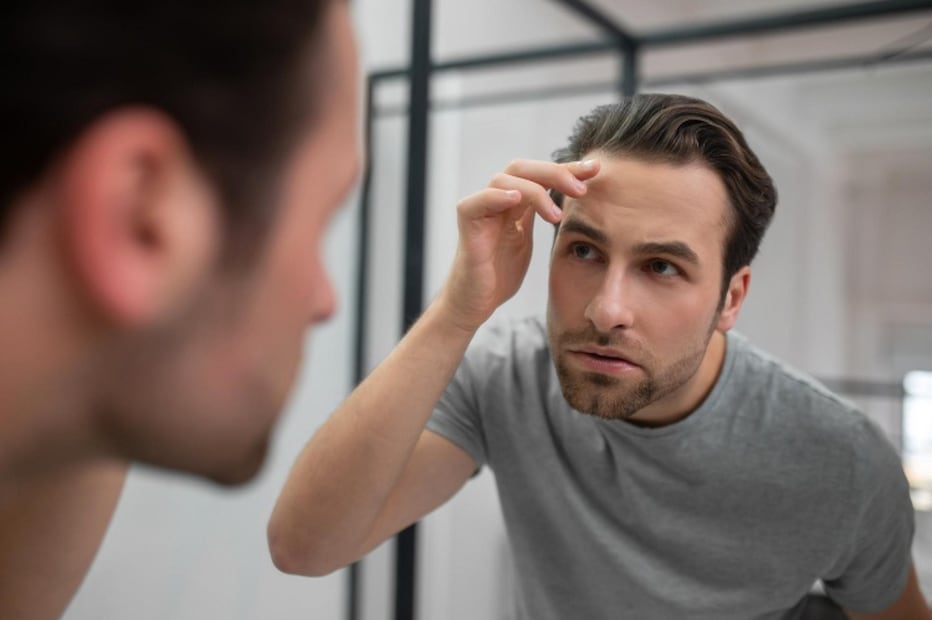 La causa más frecuente de pérdida de cabello es la calvicie común o hereditaria. Foto: Magnific