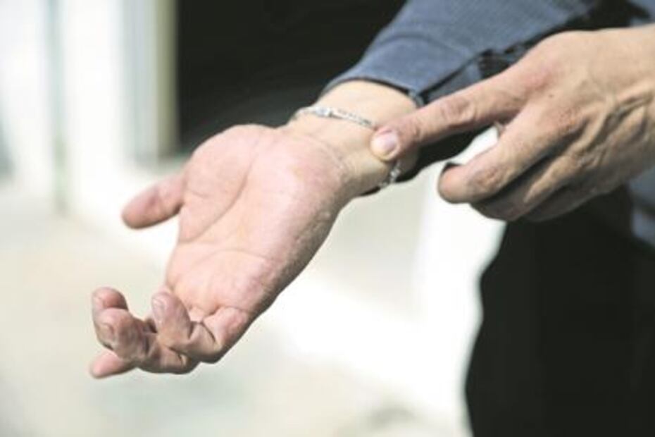  Water supply in Zimapán, Hidalgo, contaminated with arsenic