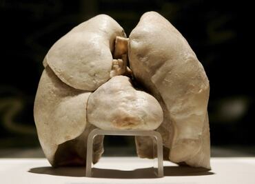 Estudio revela por qué los no fumadores padecen afecciones pulmonares graves