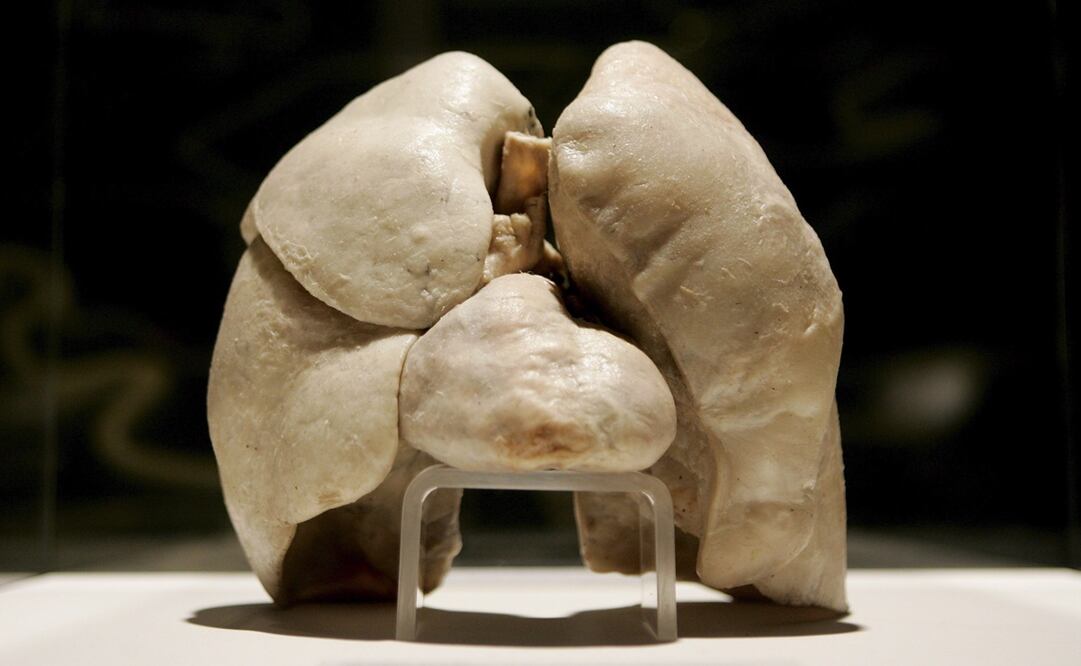 El no fumar no garantiza estar libre de EPOC. El desarrollo de los pulmones también es un factor. En la foto, los pulmones de un no fumador. Foto: EFE/STEFAN ZAKLIN, archivo