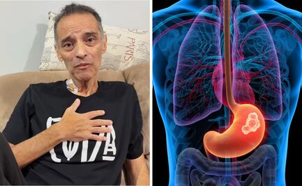 Xava Drago: ¿qué es el cáncer de estómago, enfermedad que padece el vocalista de Coda?; conoce sus principales síntomas