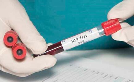 Acusan de asesinato a hombre con VIH por infectar a su novia