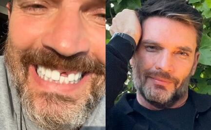 Julián Gil pierde un diente y lo enfrenta con humor: "Me visitará el ratón Pérez"