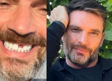 Julián Gil pierde un diente y lo enfrenta con humor: "Me visitará el ratón Pérez"