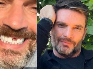 Julián Gil pierde un diente y lo enfrenta con humor: "Me visitará el ratón Pérez"