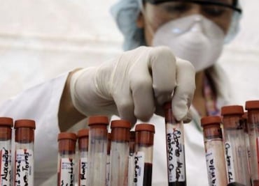 Científicos avanzan hacia una vacuna contra el VIH