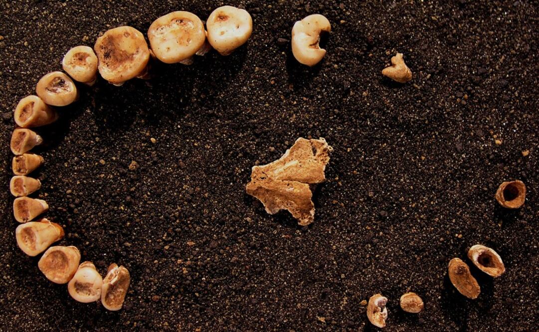 Teeth found at a 4,500-year-old burial site in central-west Mexico - Photo: University of Connecticut/AP