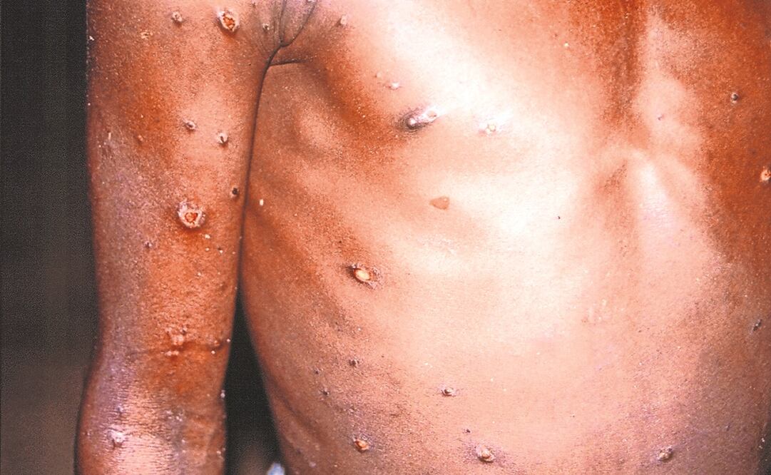 Foto: Archivo EL UNIVERSAL 