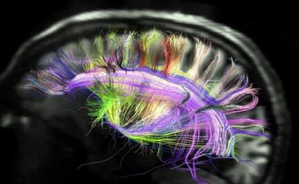 Médicos del IMSS atienden tumores cerebrales con técnicas innovadoras