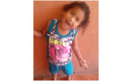 Fallece niño atacado por pitbull en Coahuila