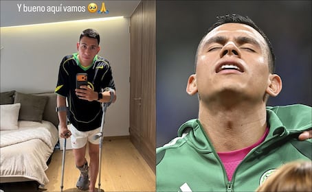 Luis Ángel Malagón reaparece en las redes sociales con férula y muletas tras su lesión