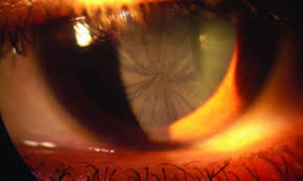 Enfermedades raras: más usuales de lo que creerías