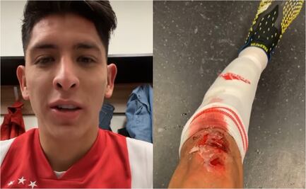 Así quedó la rodilla de Edson Álvarez, tras la victoria del Ajax