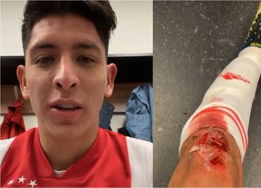 Así quedó la rodilla de Edson Álvarez, tras la victoria del Ajax