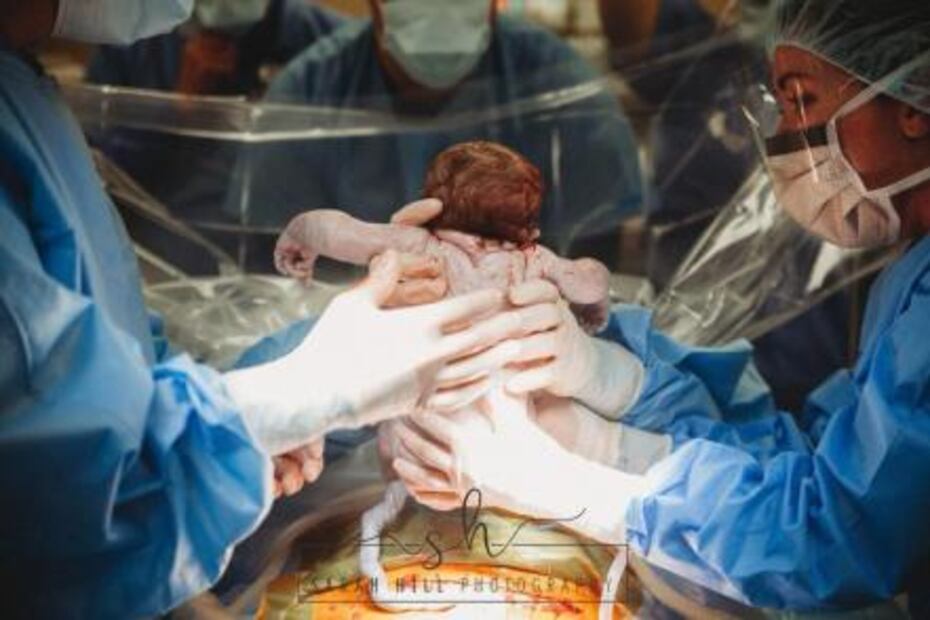 Partera de Kentucky participa en el nacimiento, por cesárea, de su propio hijo