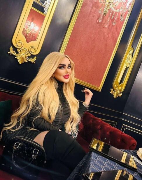Dalia Naeem, mejor conocida como la "Barbie iraquí" . Foto: Instagram