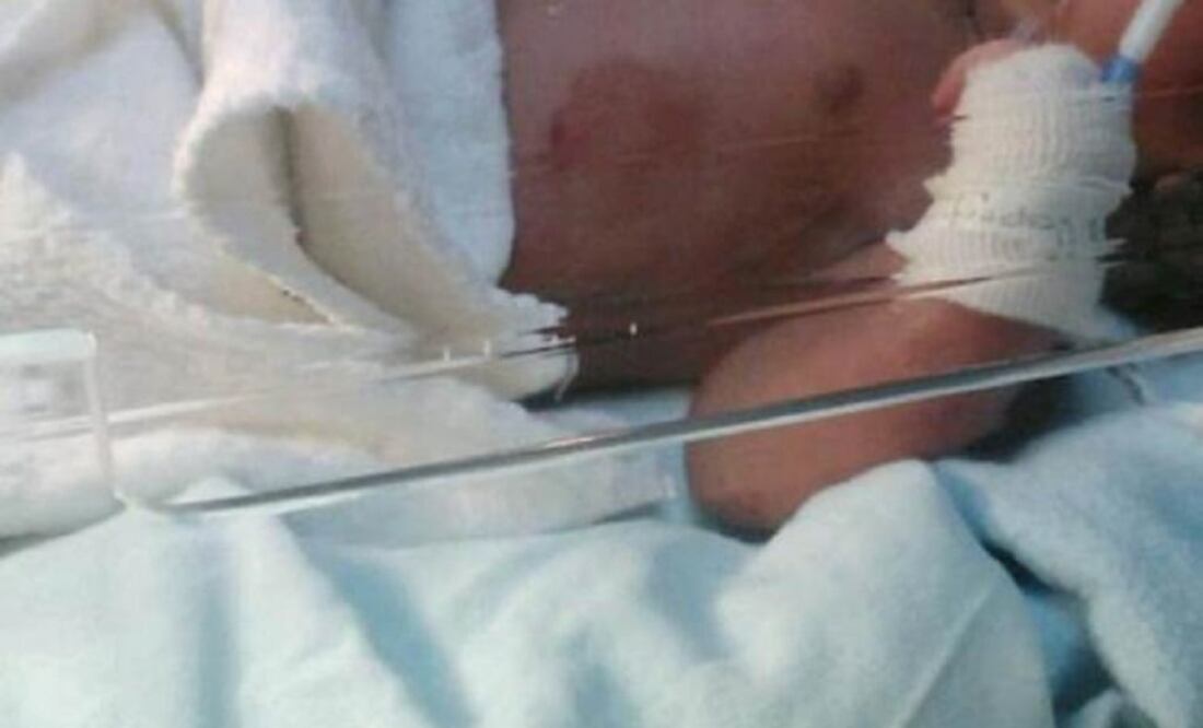 (Photo: Archive / EL UNIVERSAL)