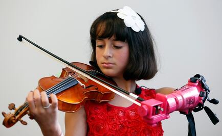 Niña violinista recibe prótesis para seguir su sueño