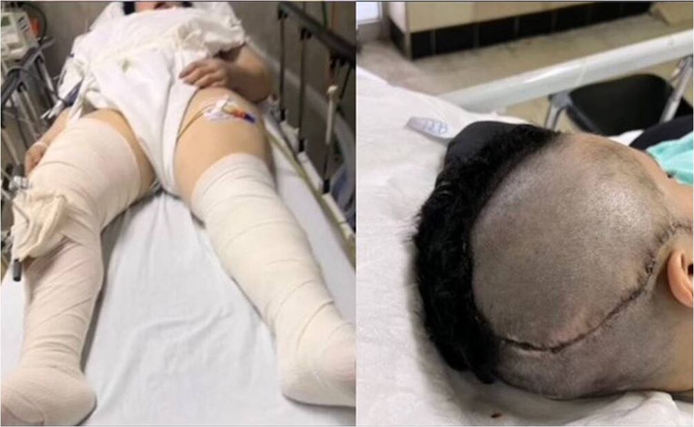 Leonor Uribe víctima de Carlos Gerardo "N" Foto: Especial