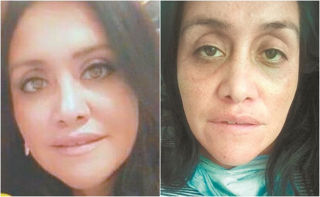 Los amigos de Adriana han platicado con ella por medio de videollamadas y le han dicho que se ve muy mal, pues su color de piel cambió, sus ojos se le hundieron y la boca se le puso demasiado blanca . FOTOS: ESPECIALES 