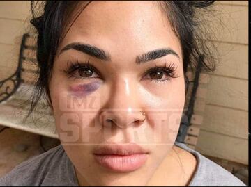 Peladora de UFC recibe golpiza de su esposo