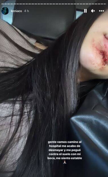 Kenia Os comparte foto con una parte del rostro golpeado y alerta a fans