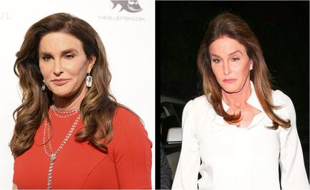 ¿Demasiadas cirugías para Caitlyn Jenner?