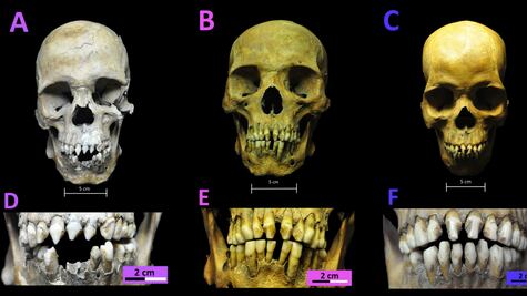 El sufrimiento que revelan tres esqueletos de esclavos africanos descubiertos en México