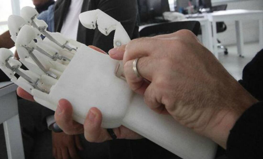 Maxence no podrá llevar a cabo gestos complejos, como los imprescindibles para atarse los cordones de los zapatos, pero sí abrir y cerrar los dedos