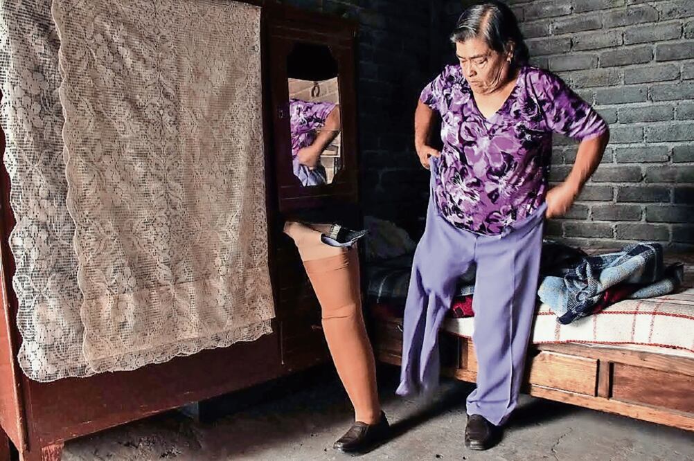 A ocho años de los atentados terroristas ocurridos el 15 de septiembre de 2008 en Morelia, los afectados señalan que su salud va en detrimento (ARCHIVO. EL UNIVERSAL)