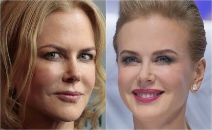 El nuevo rostro de Nicole Kidman