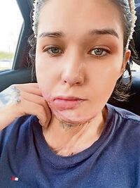 Liliana vive calvario de un año; sus atacantes, libres