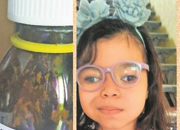 Marianita: 5 años de edad, con 20 cirugías