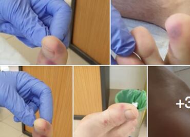 Sin comprobar, inflamaciones en el cuerpo por Covid-19