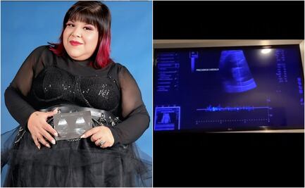 Influencer Aimep3 sorprende al anunciar embarazo; presume ultrasonido en Instagram