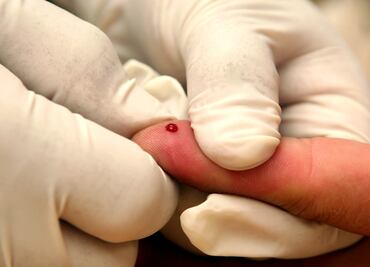 Identifican en la sangre pequeñas moléculas que revelarían el riesgo de demencia