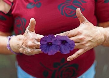 Carolina Hernández: “Carmen sí sufrió daño sicológico por ataque con ácido”