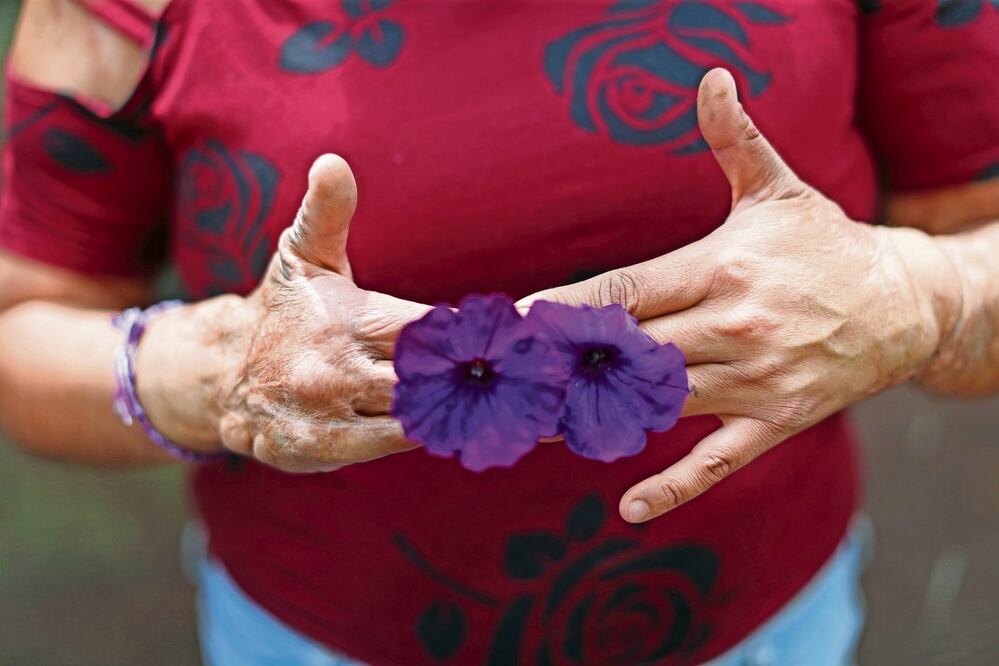 Acid Survivors Trust International señala que 80% de las víctimas de ataques con ácido en el mundo son mujeres. Foto: Archivo El Universal