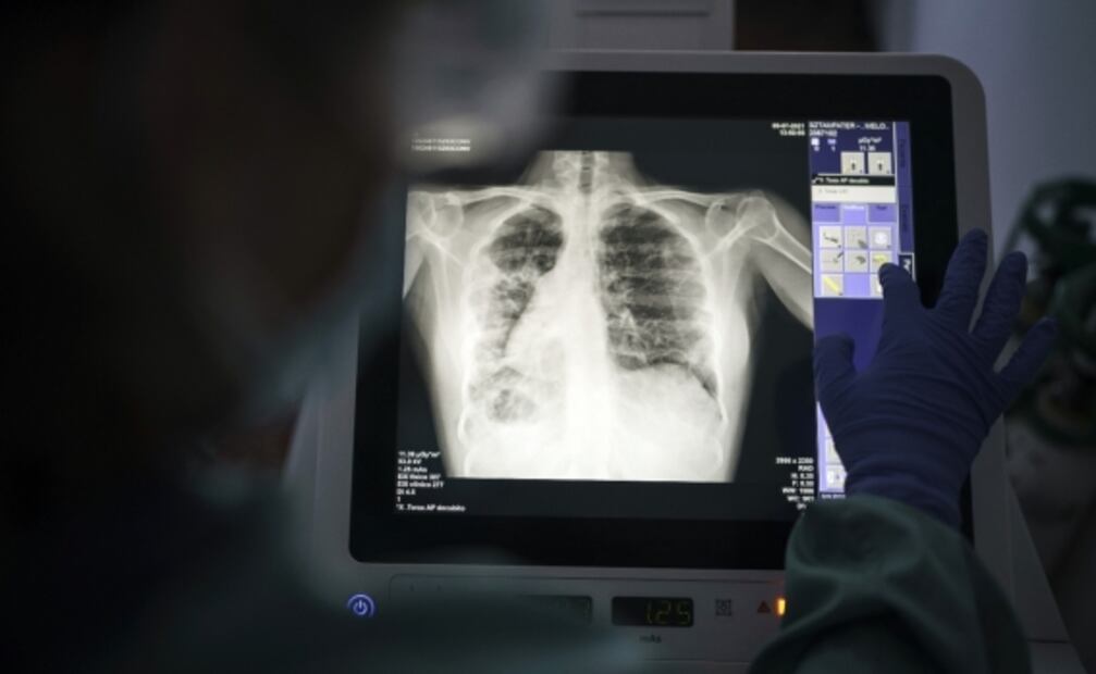 Contaminación en el aire contribuye a la gravedad del Covid-19: Estudio