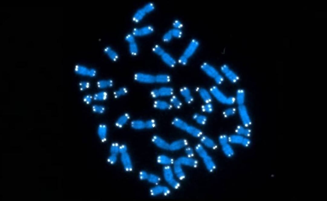 La respuesta puede estar en la presencia de una copia adicional de uno de los aproximadamente 230 genes del cromosoma 21. (FOTO: Archivo EL UNIVERSAL) 