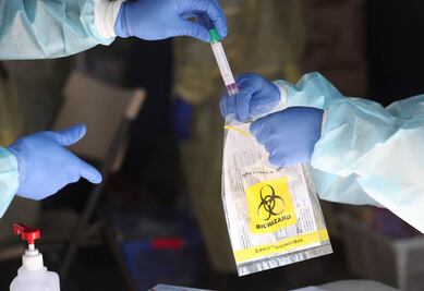Coronavirus: número de casos de Covid-19 en el mundo supera los 10 millones