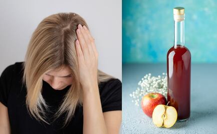 Cómo usar vinagre de manzana para combatir la caspa 