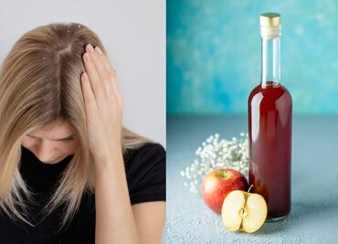 Cómo usar vinagre de manzana para combatir la caspa