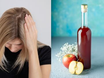 Cómo usar vinagre de manzana para combatir la caspa