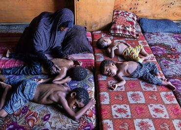 Madres y sus bebés enfrentan inanición en Gaza; los hospitales están desbordados