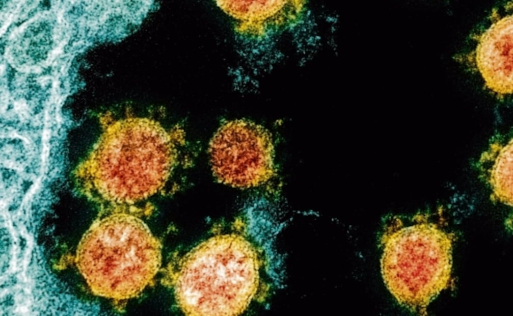 Descubren la proteína que provoca que nos enfermemos de Covid-19